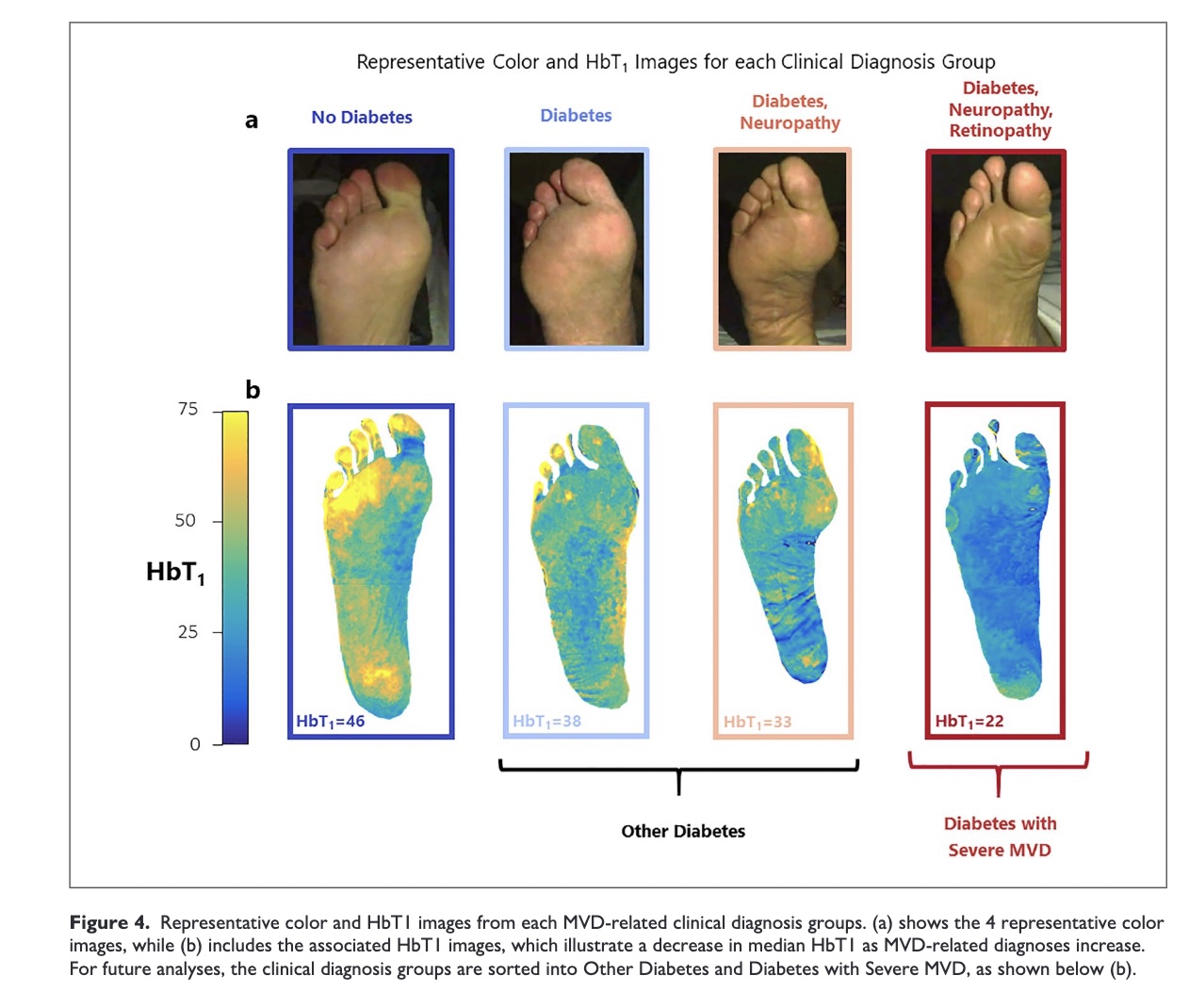 Stratification of Microvascular Disease Severity in the Foot Using